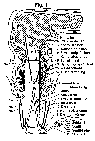 ExfecatorFig.1